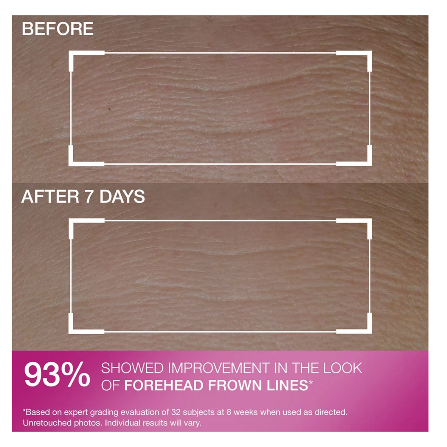 StriVectin Anti-Wrinkle Peptide Plump Line Filling Bounce Serum