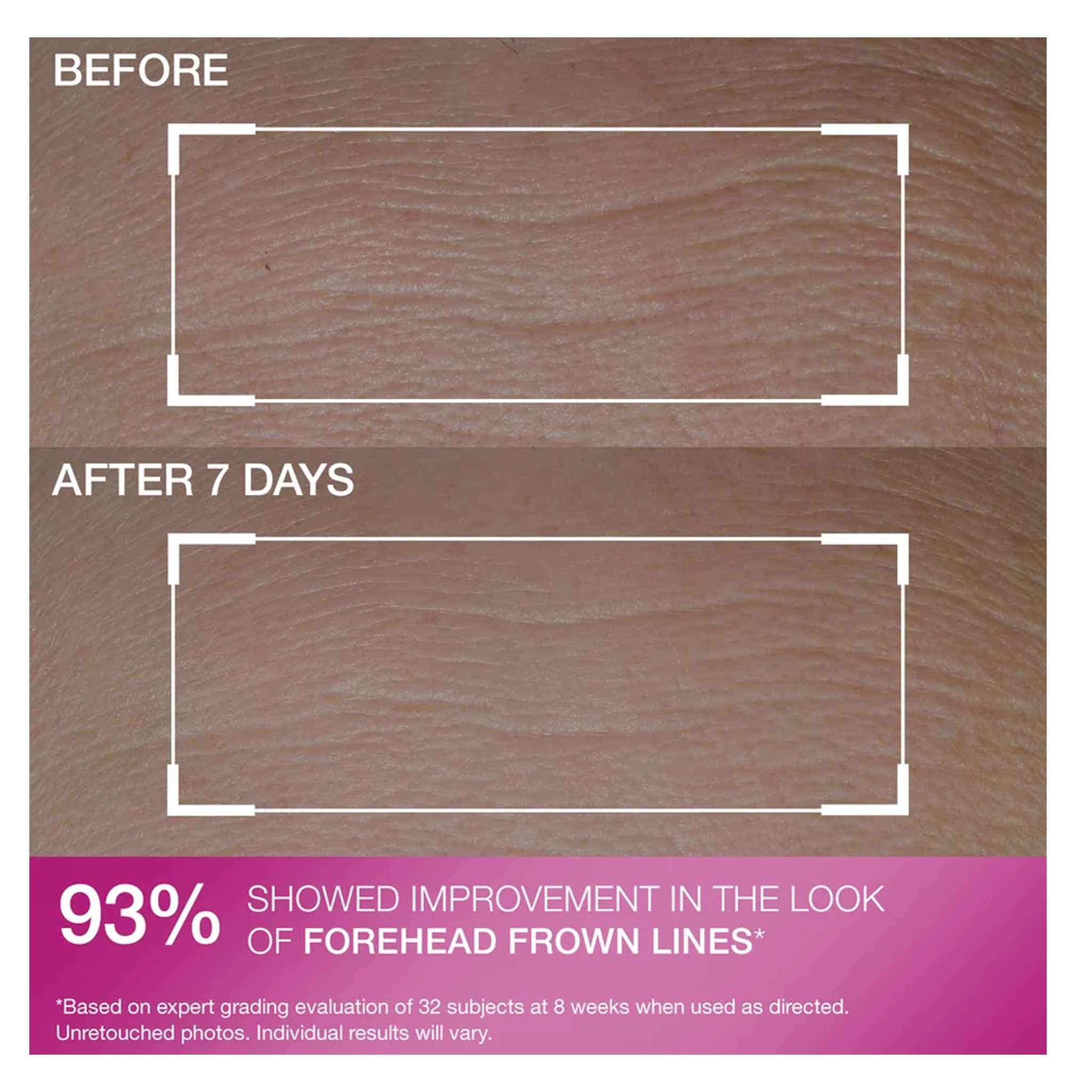 StriVectin Anti-Wrinkle Peptide Plump Line Filling Bounce Serum