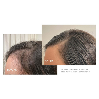 Virtue Hair Rejuvenation Treatment (Drug Free) 1 Month Supply