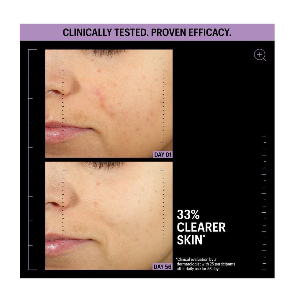 Allies of Skin Azelaic &amp; Kojic Advanced Clarifying Serum