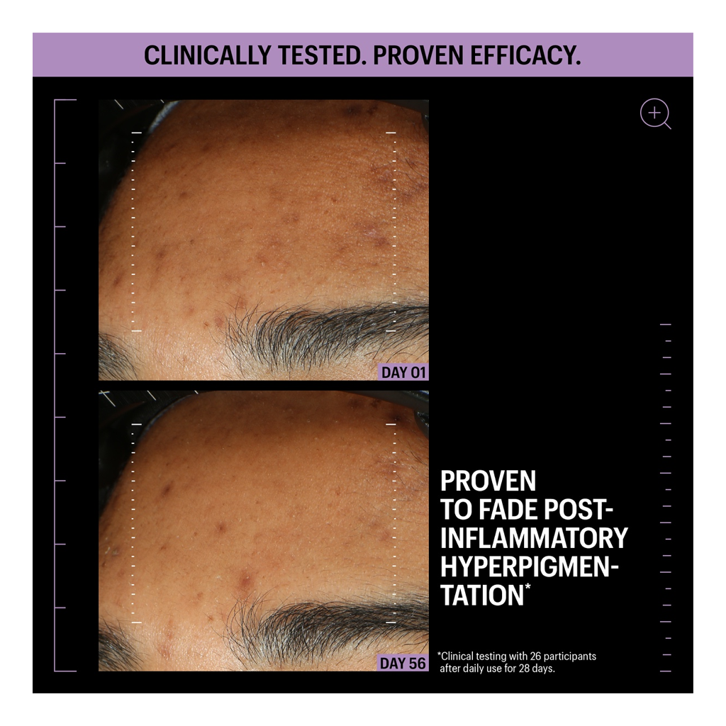 Allies of Skin Azelaic &amp; Kojic Advanced Clarifying Serum