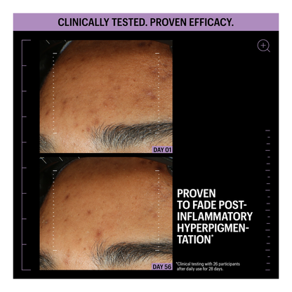 Allies of Skin Azelaic &amp; Kojic Advanced Clarifying Serum