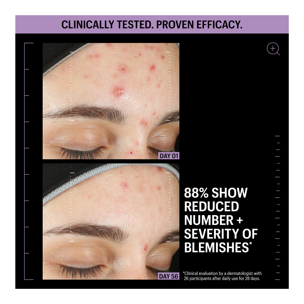 Allies of Skin Azelaic &amp; Kojic Advanced Clarifying Serum