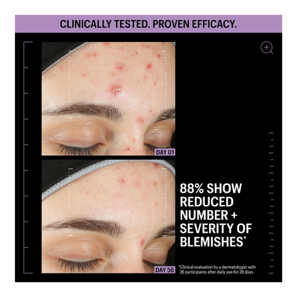 Allies of Skin Azelaic &amp; Kojic Advanced Clarifying Serum