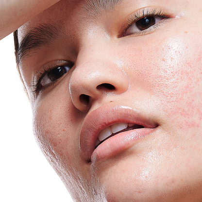 Allies of Skin Molecular Saviour Probiotics Treatment Mist