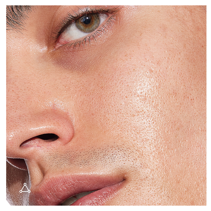 Allies of Skin Promise Keeper Nightly Blemish Treatment