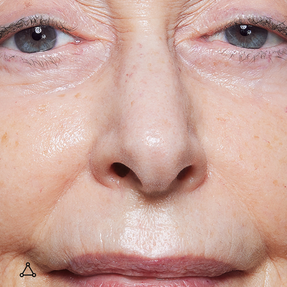 Allies of Skin Prebiotic and Niacinamide Pore Refining Booster-Coming Soon