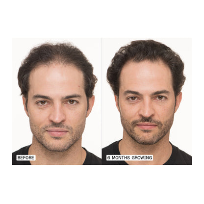 Nutrafol Men 50+