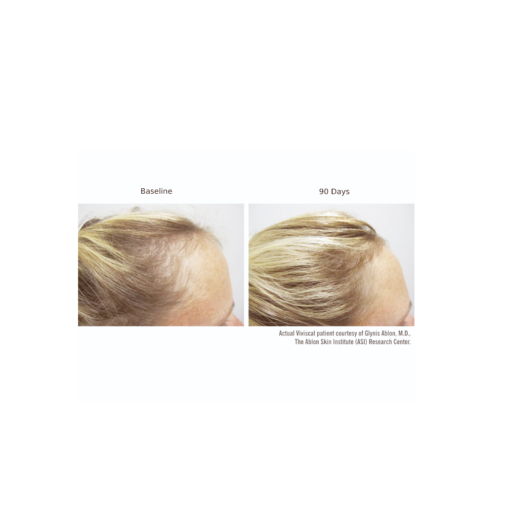 Viviscal Professional Hair Growth Program