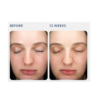 PCA Skin Triple Exfoliation Peel Pads