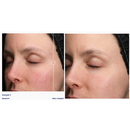 Obagi Retinol + PHA Refining Night Cream