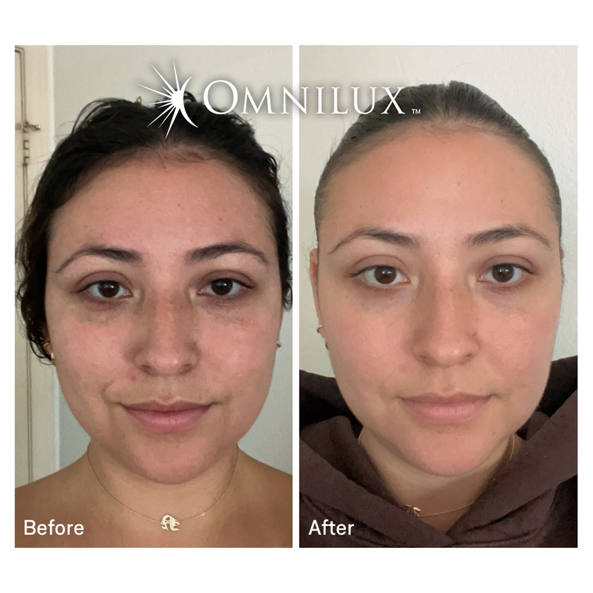 Omnilux Contour Face