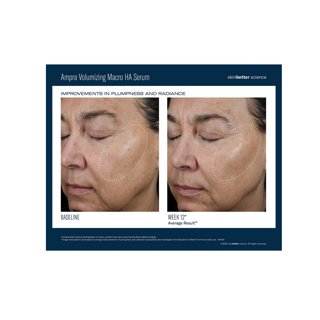 Skinbetter Science Ampra Volumizing Macro HA Serum