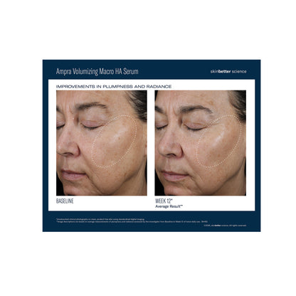 Skinbetter Science Ampra Volumizing Macro HA Serum