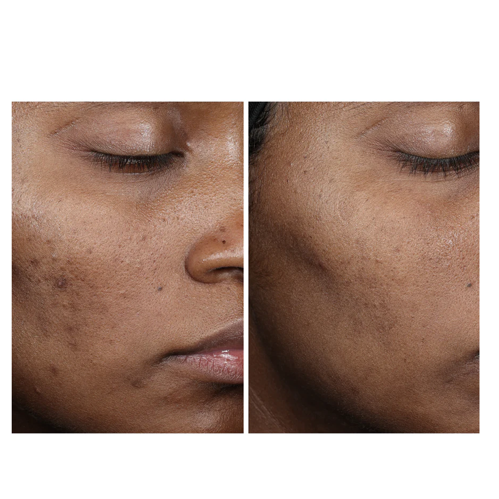 Ourself Complexion Brightening Serum