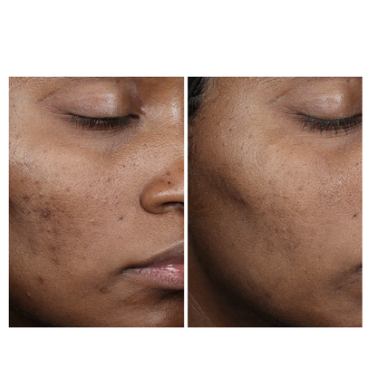 Ourself Complexion Brightening Serum