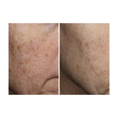 Ourself Complexion Brightening Serum