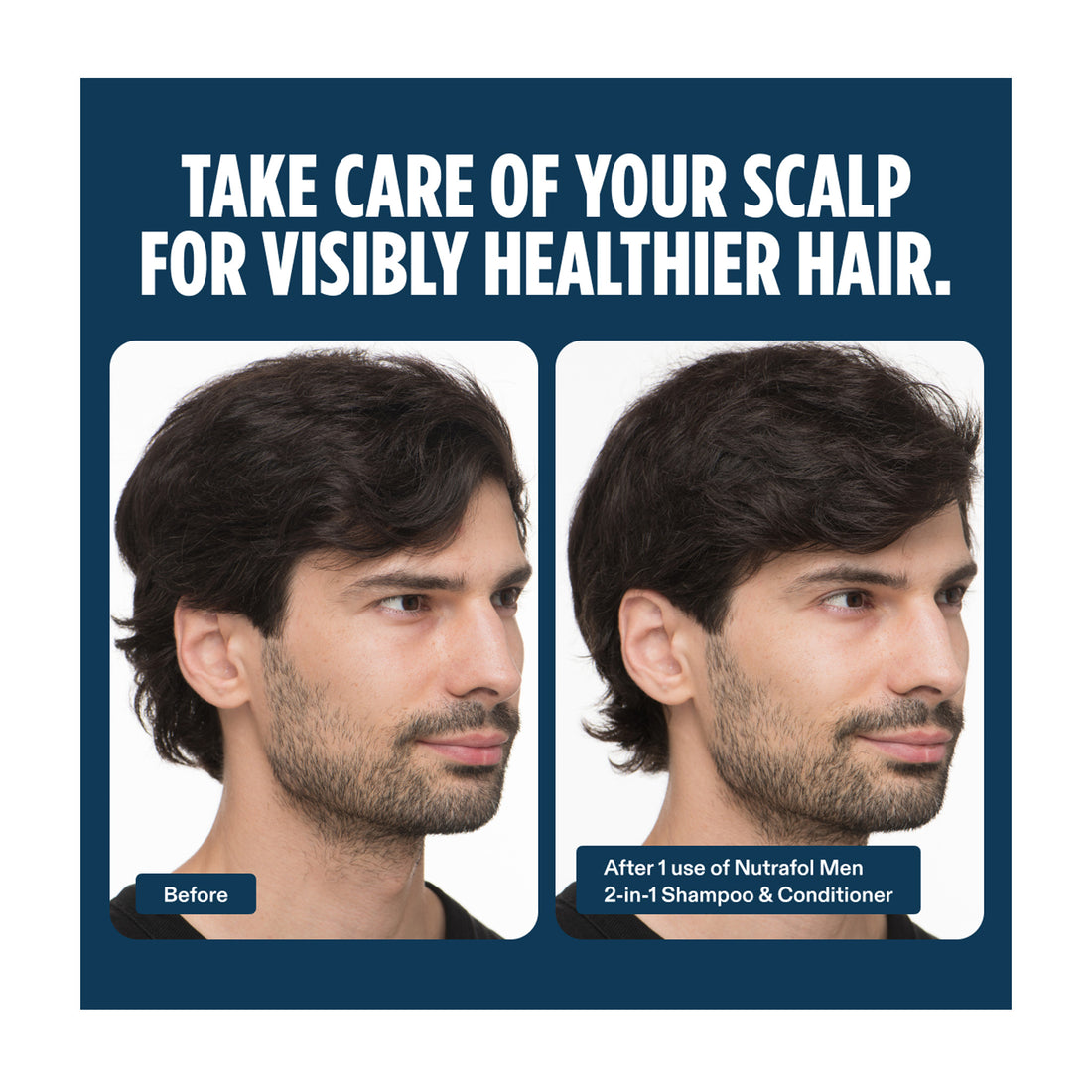 Nutrafol Men&