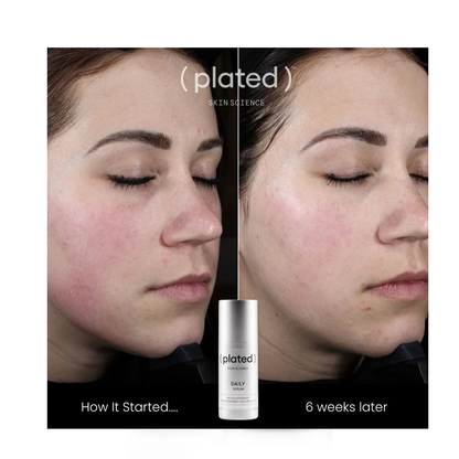 Plated DAILY Serum Refill