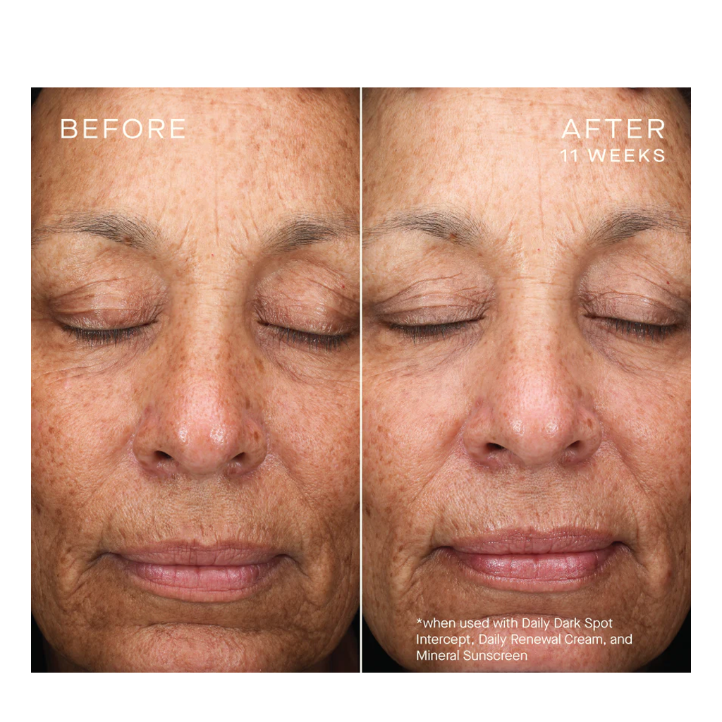 Ourself Daily Dark Spot Intercept