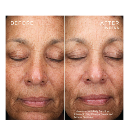 Ourself Daily Dark Spot Intercept