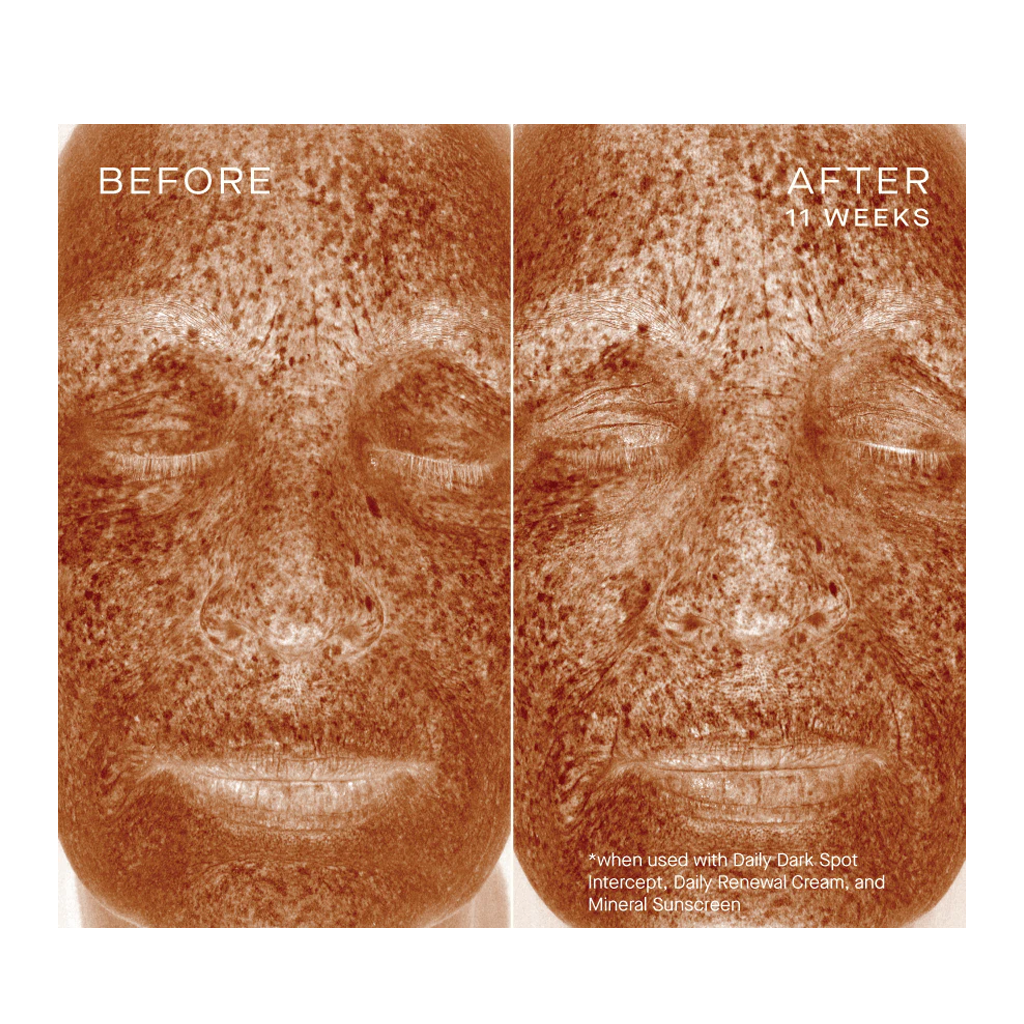 Ourself Daily Dark Spot Intercept