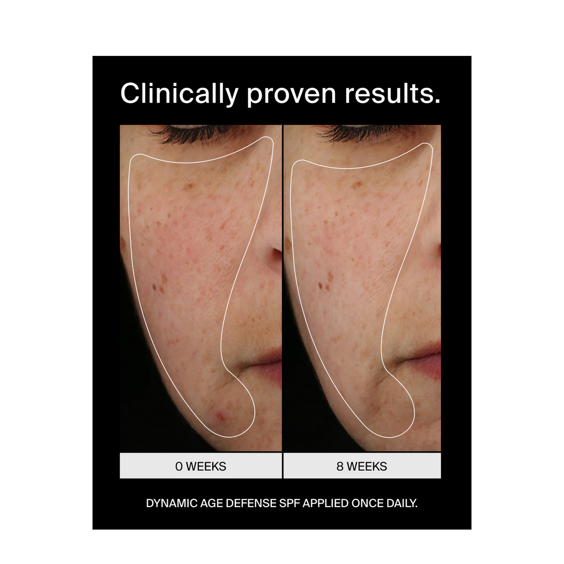 Pavise Dynamic Age Defense Refill