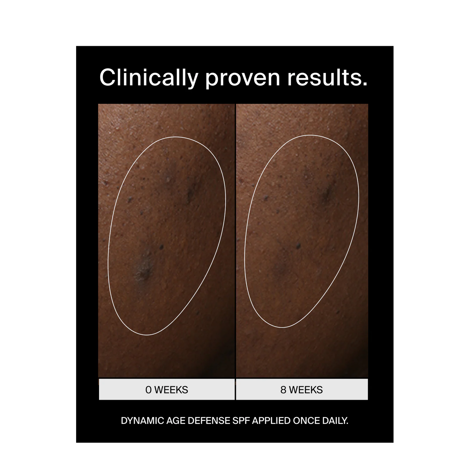 Pavise Dynamic Age Defense Refill