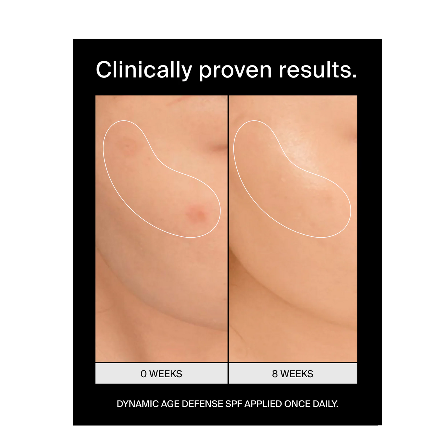 Pavise Dynamic Age Defense