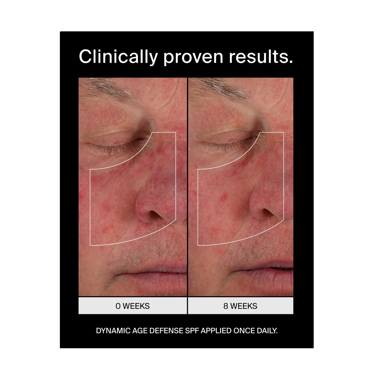 Pavise Dynamic Age Defense