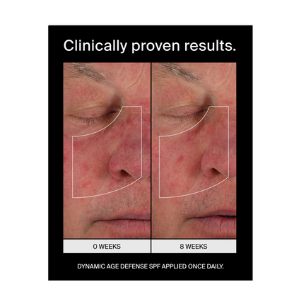 Pavise Dynamic Age Defense