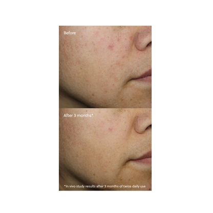 Eminence Organic Vitamin C+ Serum