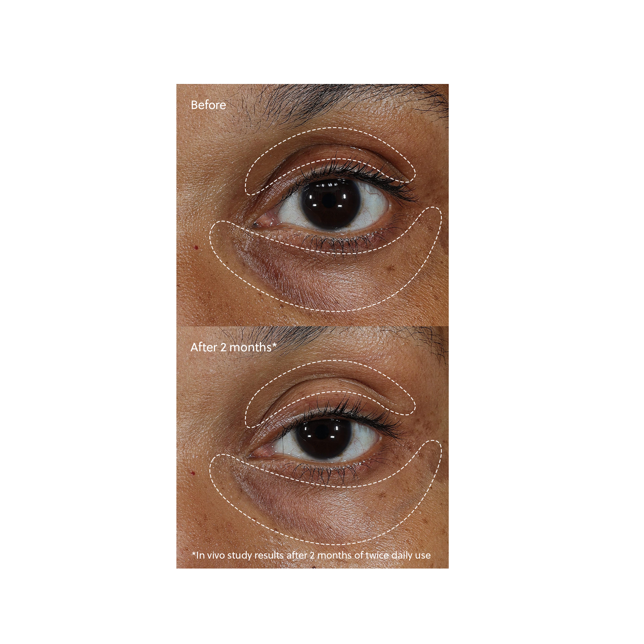 Eminence Organic Vitamin C+ Eye Cream