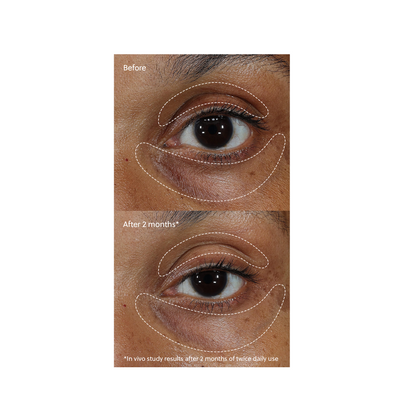 Eminence Organic Vitamin C+ Eye Cream