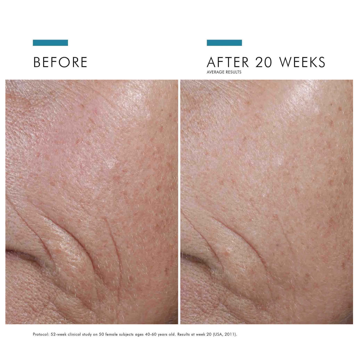 SkinCeuticals C E Ferulic 1 fl oz. SOLD OUT-Buy 1 Dermavenue C E Essential Serum Get a Your Second Bottle FREE (Copy)