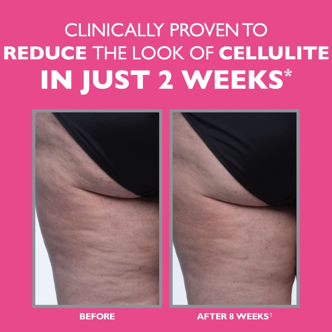 Peter Thomas Roth FIRMx Tight &amp; Toned Cellulite Treatment