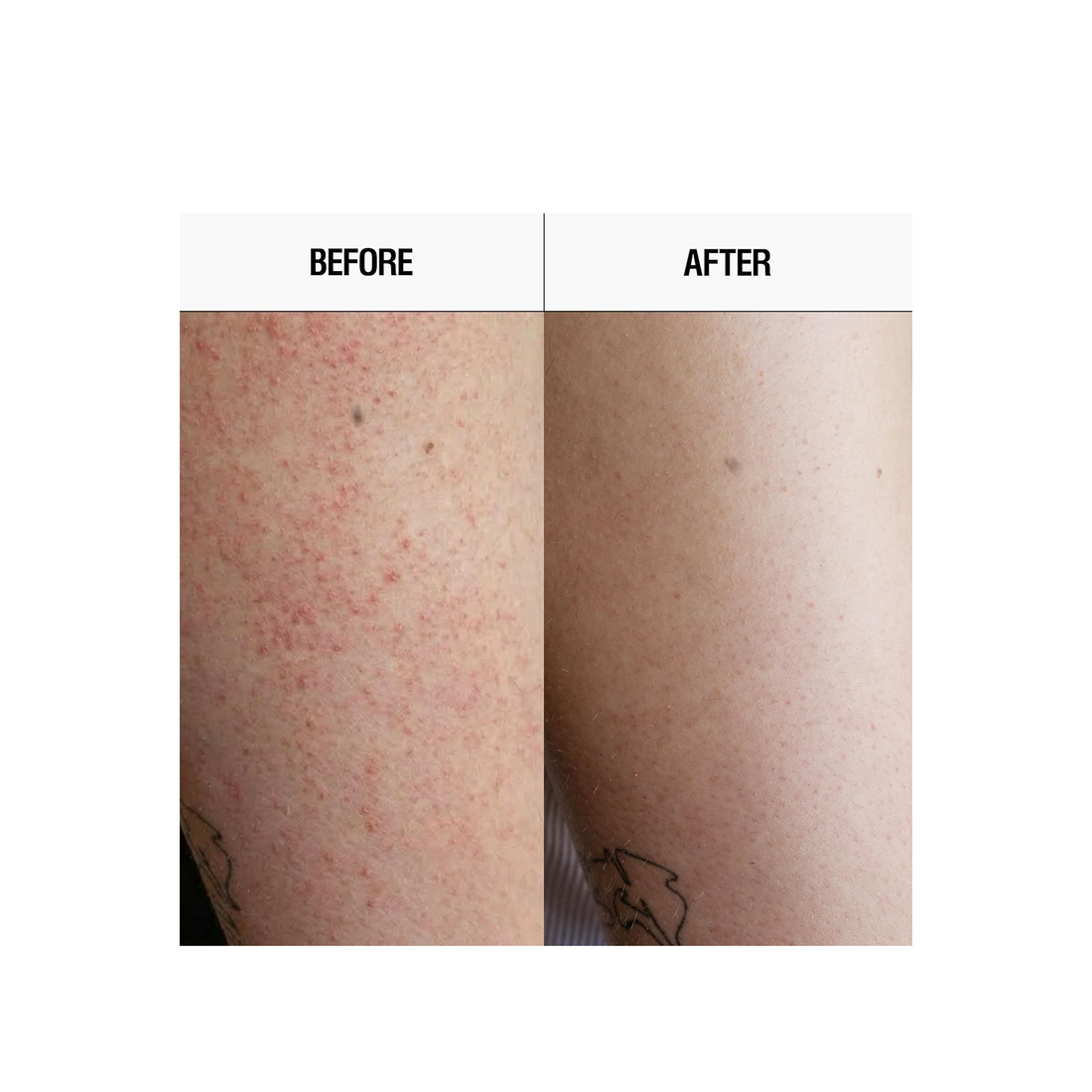 Grown Alchemist Resurfacing Targeted Body Lotion