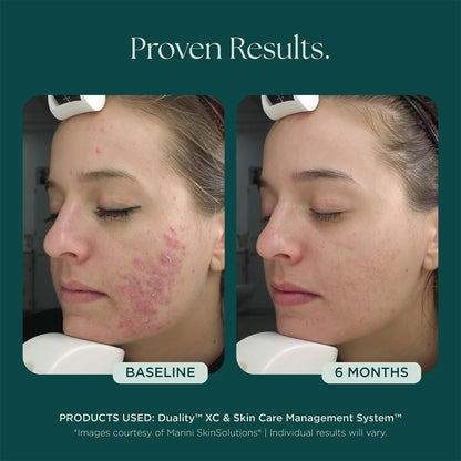 Marini SkinSolutions Duality XC