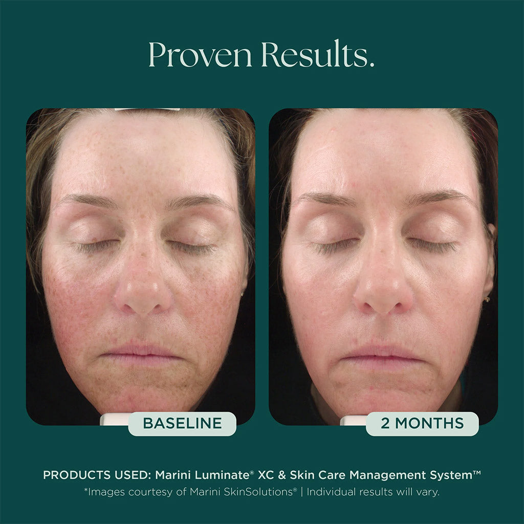 Marini SkinSolutions Marini Luminate XC Face Lotion