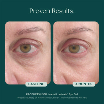 Marini SkinSolutions Luminate Eye Gel