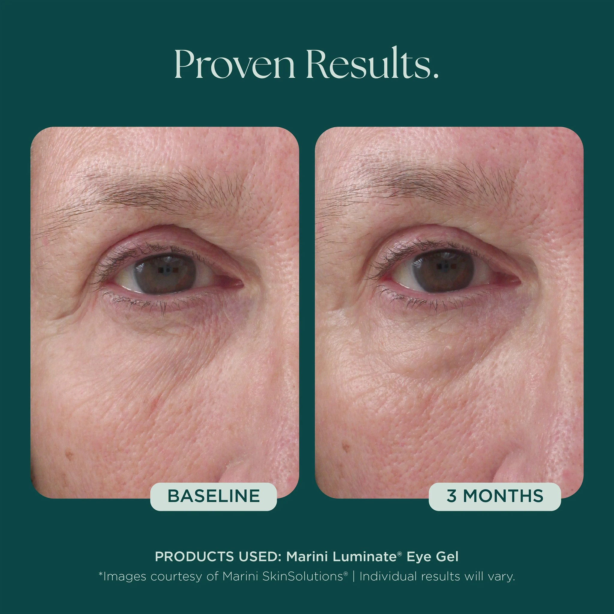 Marini SkinSolutions Luminate Eye Gel