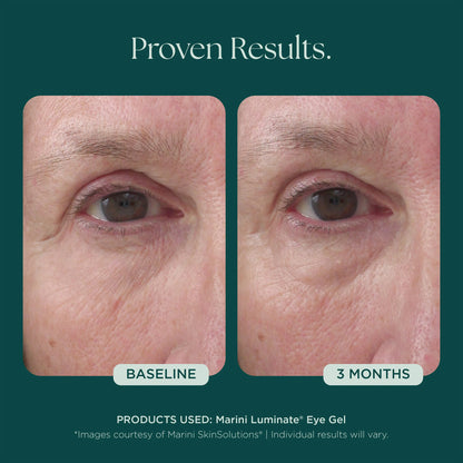 Marini SkinSolutions Luminate Eye Gel
