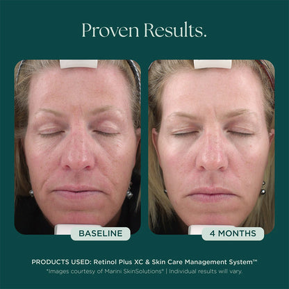 Marini SkinSolutions Retinol Plus XC