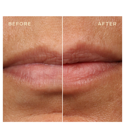 Ourself Replenishing Lip Filler