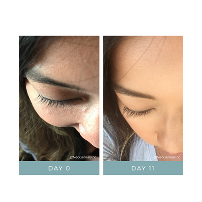 NeoGenesis NeoLash 3ml