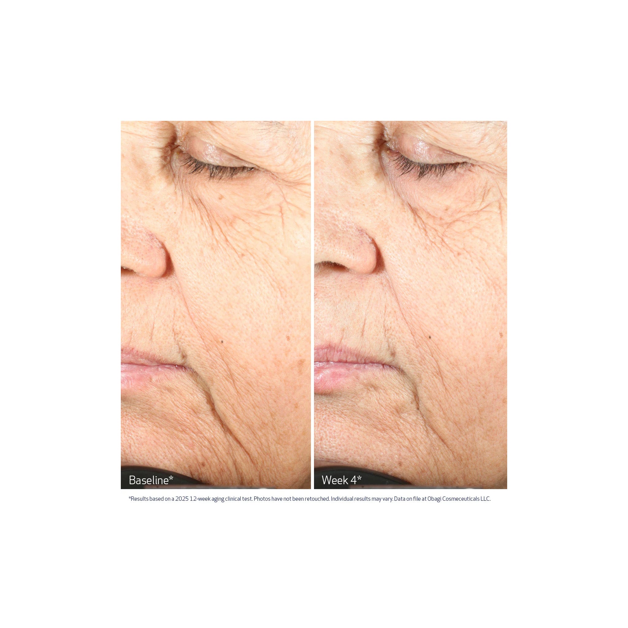 Obagi Medical Cellular Renewal Serum