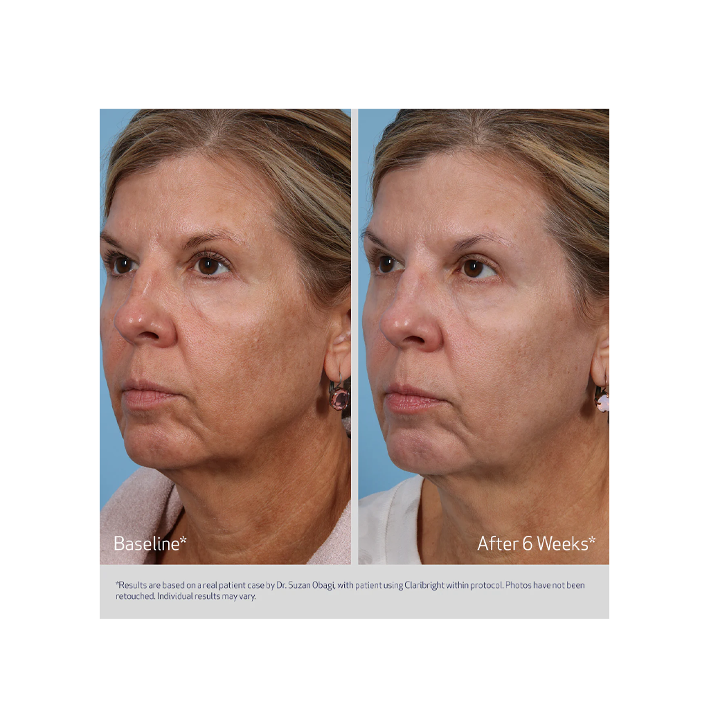 Obagi Claribright Radiance Brightening Lotion