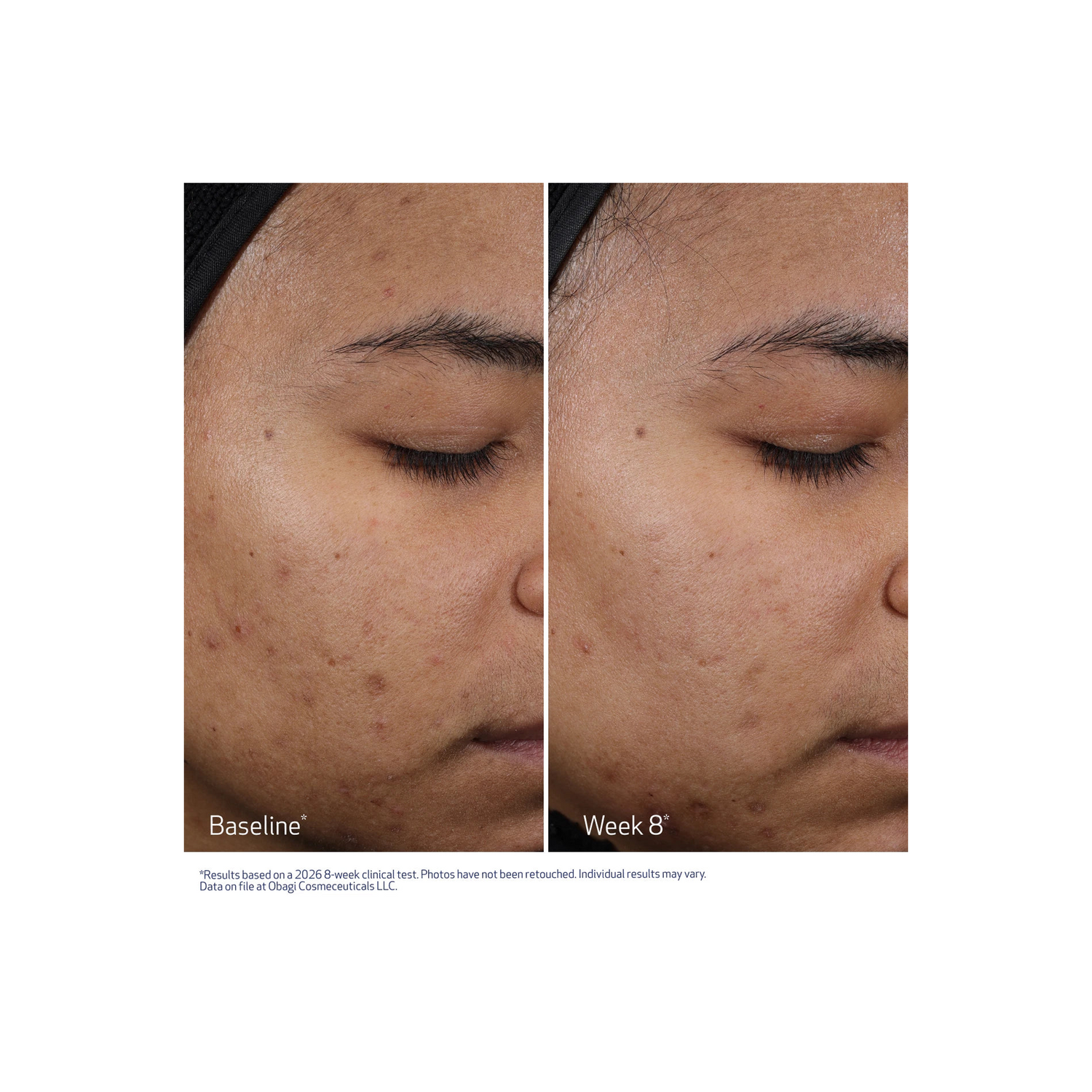 Obagi Cleziderm M.D. Resurfacing Multi-Acid Peel Pads