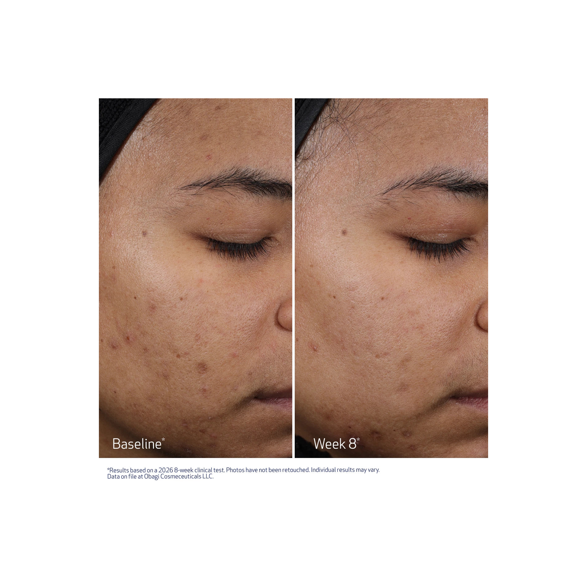 Obagi Cleziderm M.D. Resurfacing Multi-Acid Peel Pads