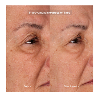 Pavise Bioadaptive Stress Repair